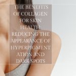 The Benefits of Collagen for Skin Health: Reducing the Appearance of Hyperpigmentation And Dark Spots